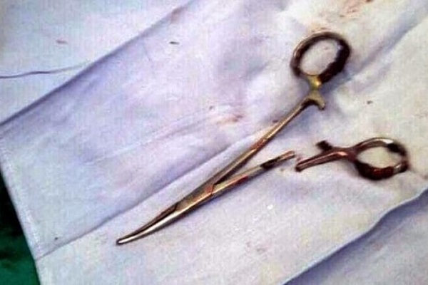 India After Five Years Scissors Removed From Woman Stomach